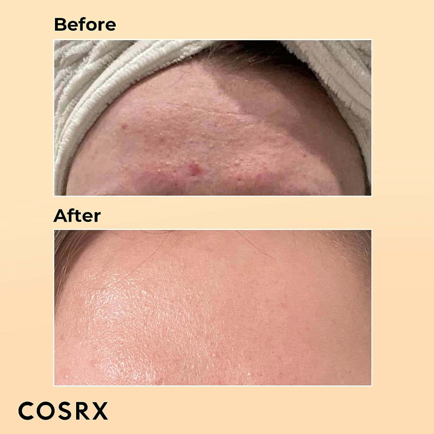 Cosrx Advanced Snail 96 Mucin Power Essence Cosrx