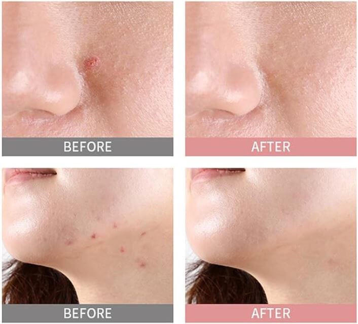 Mizon Goodbye Blemish Pink Spot Mizon