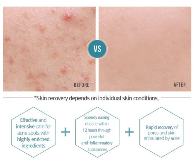 Pyunkang Yul Acne Spot Cream Pyunkang Yul