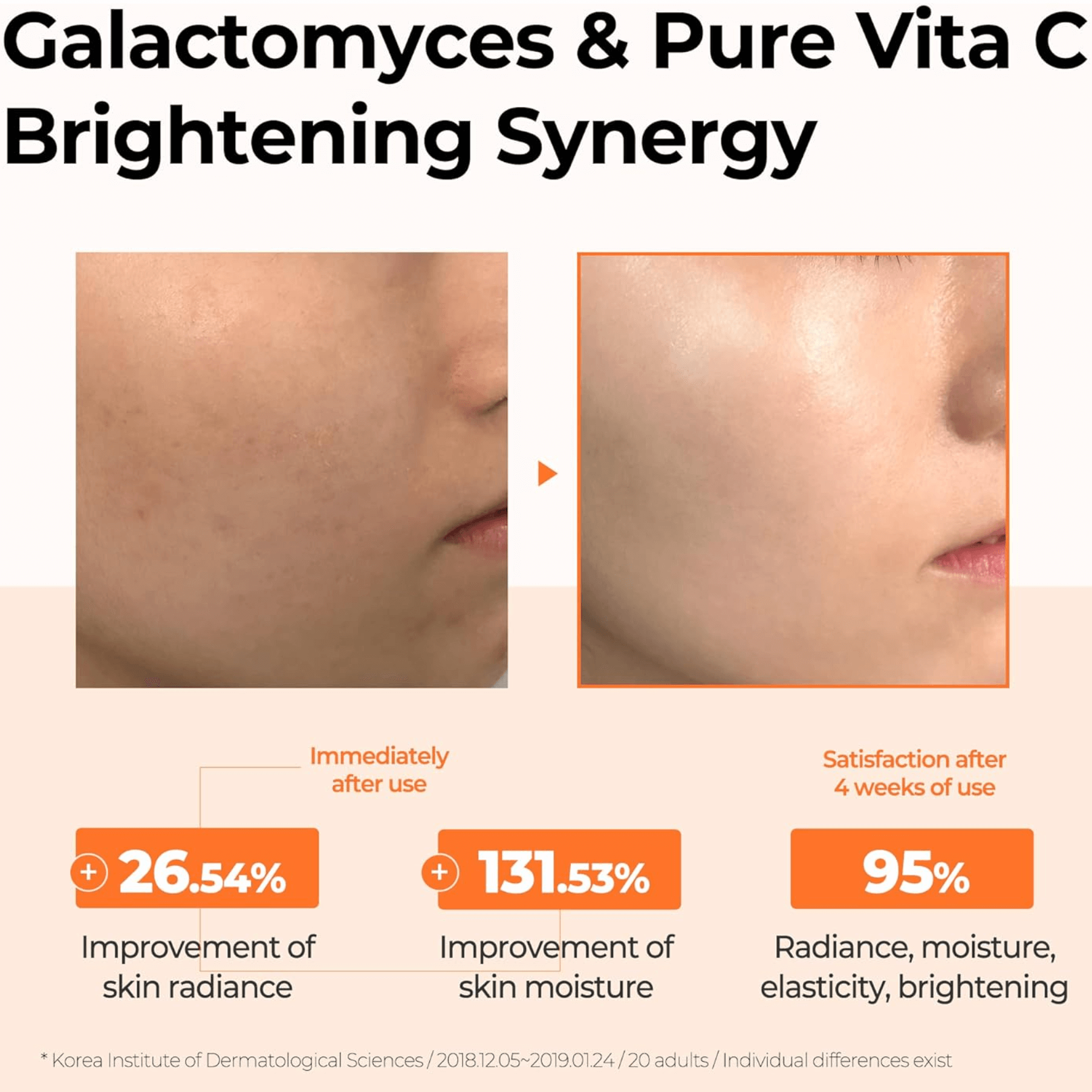 Some By Mi Galactomyces Pure Vitamin C Glow Toner Some by Mi