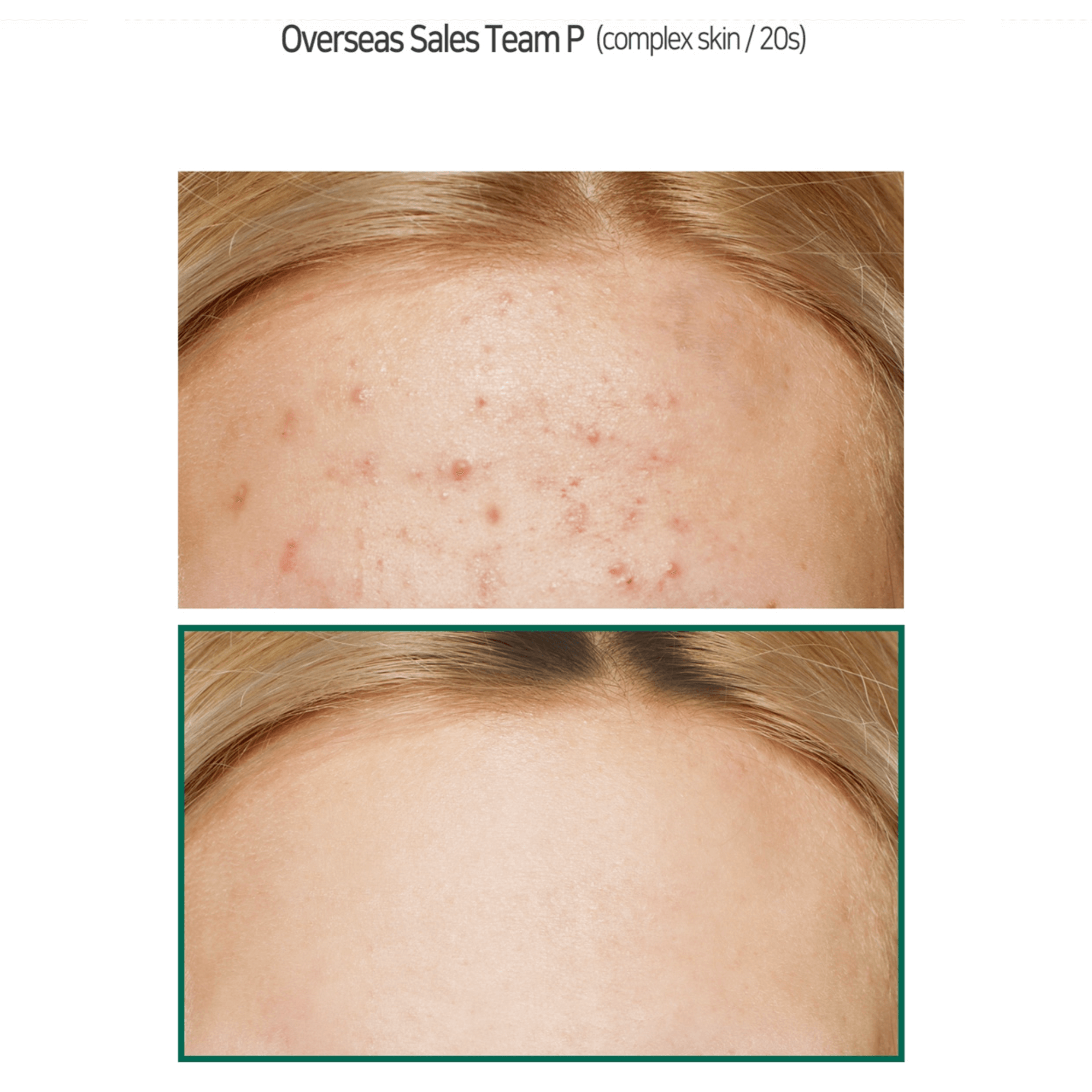 Some by Mi AHA BHA PHA 30 Days Miracle Cream Some by Mi